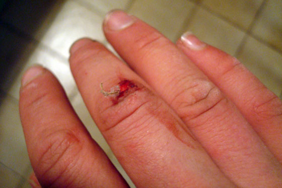 Skinned knuckle